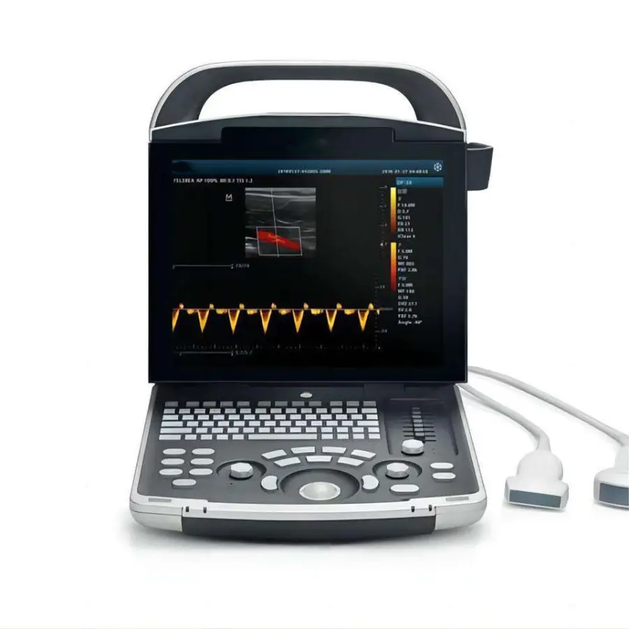 PD30 Portable 3D/4D Color Doppler Ultrasound Machine Hospital Pregnancy Scanner Original Preferential Price — view 1