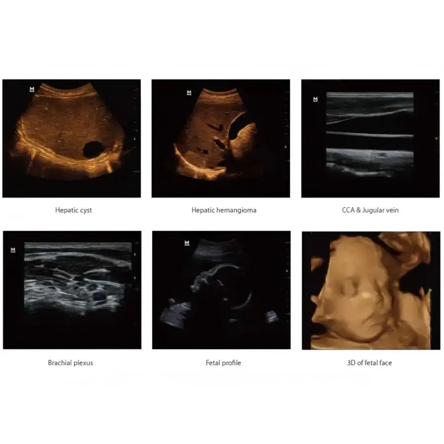 Portable B/W Dp-50 Ultrasound Machine DP50 Clinical Application Ultrasound Scanner Instrument Price — image 6