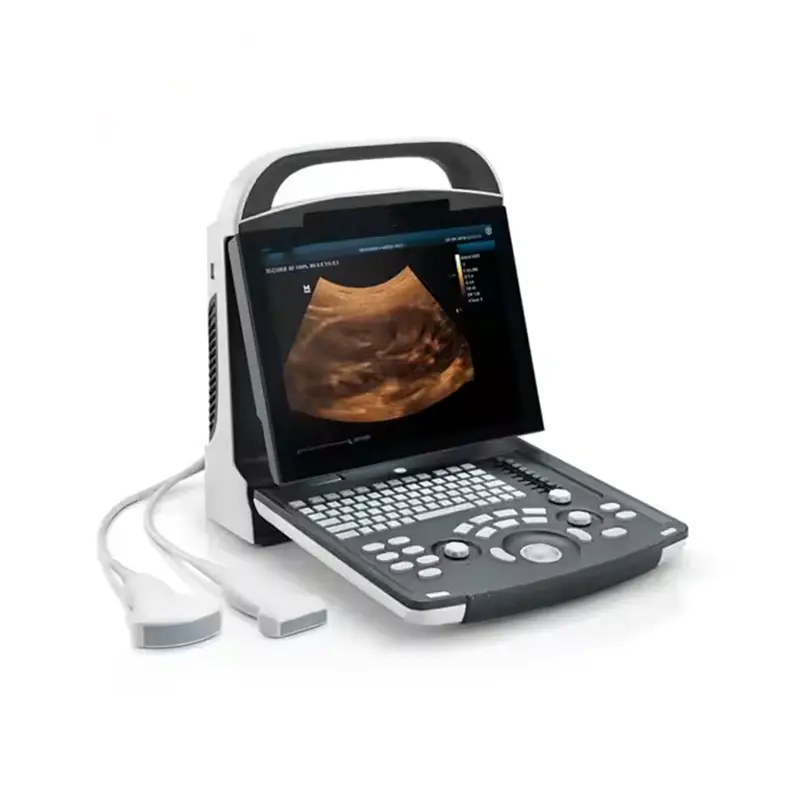 PD30 Portable 3D/4D Color Doppler Ultrasound Machine Hospital Pregnancy Scanner Original Preferential Price — image 3