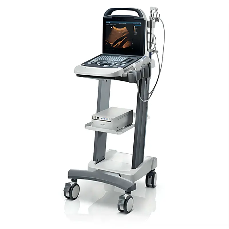 PD30 Portable 3D/4D Color Doppler Ultrasound Machine Hospital Pregnancy Scanner Original Preferential Price — image 4