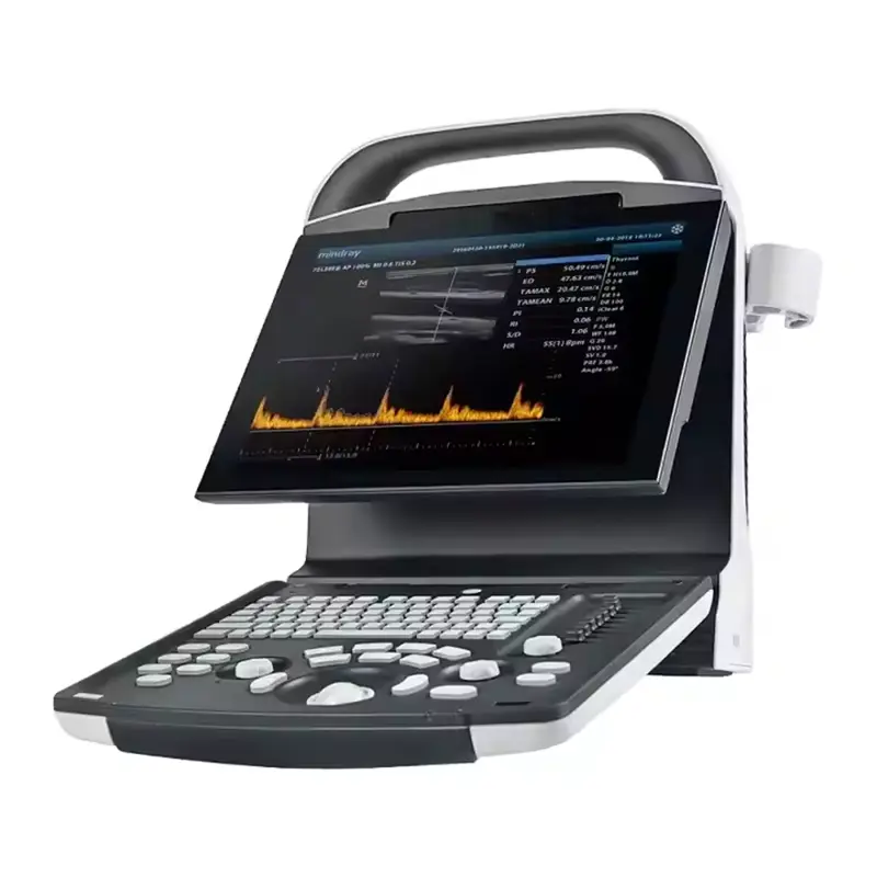 PD30 Portable 3D/4D Color Doppler Ultrasound Machine Hospital Pregnancy Scanner Original Preferential Price — image 5