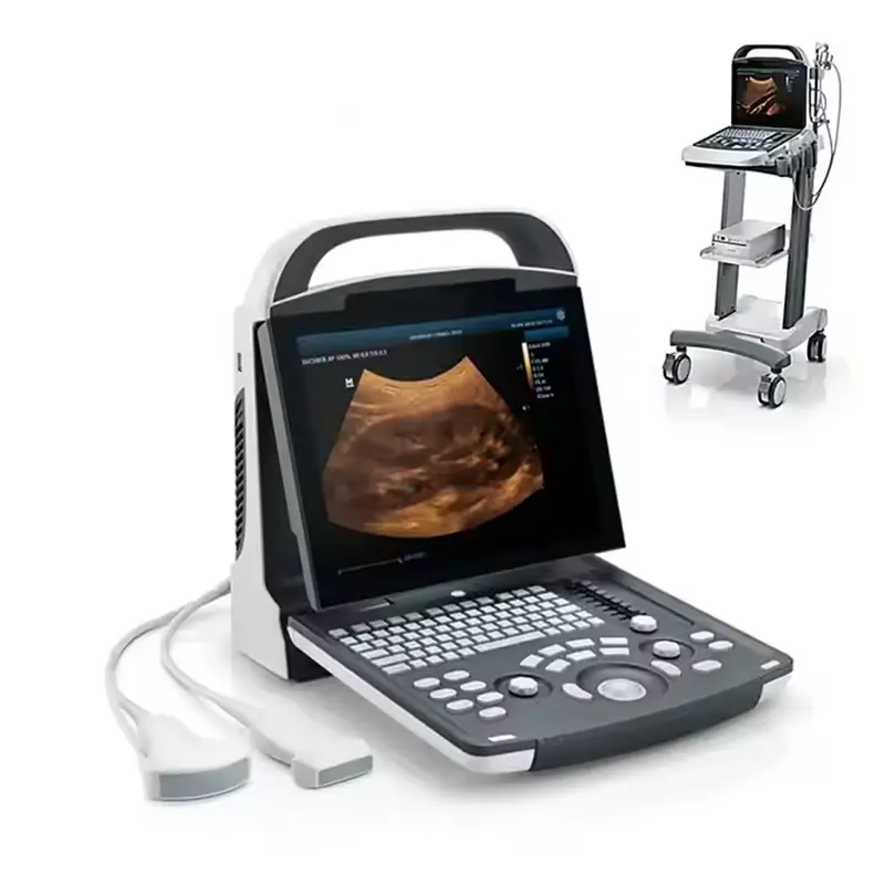 PD30 Portable 3D/4D Color Doppler Ultrasound Machine Hospital Pregnancy Scanner Original Preferential Price — image 6