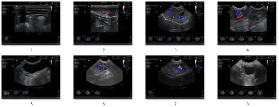 Hospital Medical Color Ultrasound Scanner Machine with 3 Convex Probes Superior Imaging Equipment — image 6