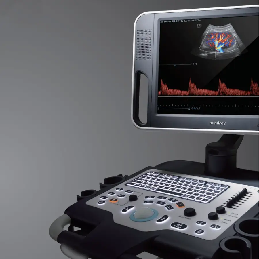 Ultrasound Machine Color Doppler 3D/4D DC 30 Ultrasound Instrument Equipment — image 5