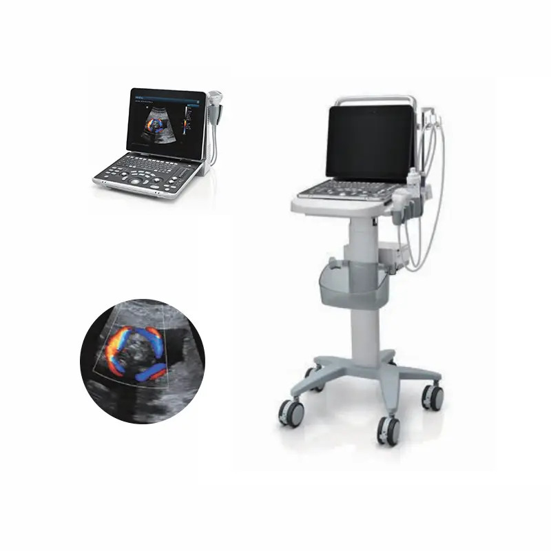 Medical Ultrasound Accessories Z50BW Electric Convex Probe Portable Color Doppler 3D 4D Ultrasound Imaging System Scanner — image 5