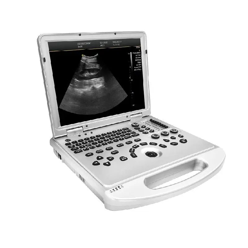 Portable Electric Color Doppler Ultrasound Scanner with High Resolution Monitor for Veterinary and Human Use — image 2