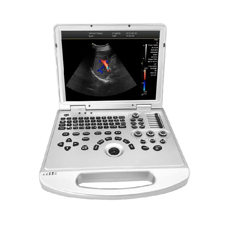 Portable Electric Color Doppler Ultrasound Scanner with High Resolution Monitor for Veterinary and Human Use — image 5