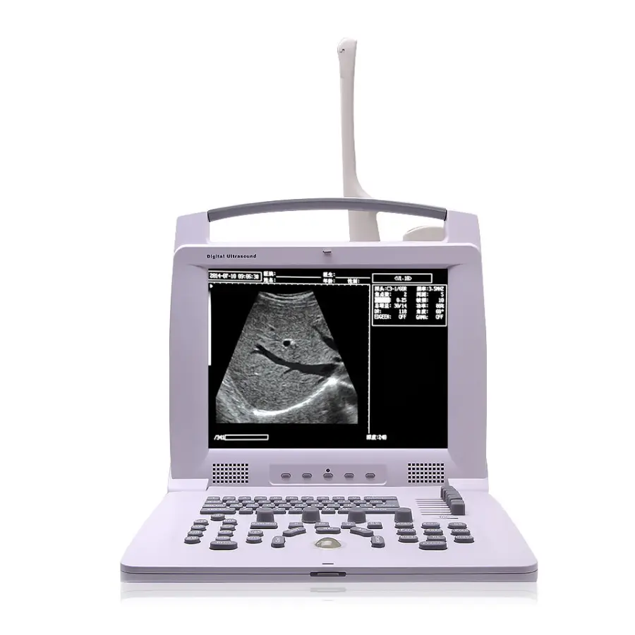 Portable Human B/W Ultrasound Machine Medical B&W Digital Ultrasound Scanner — view 1
