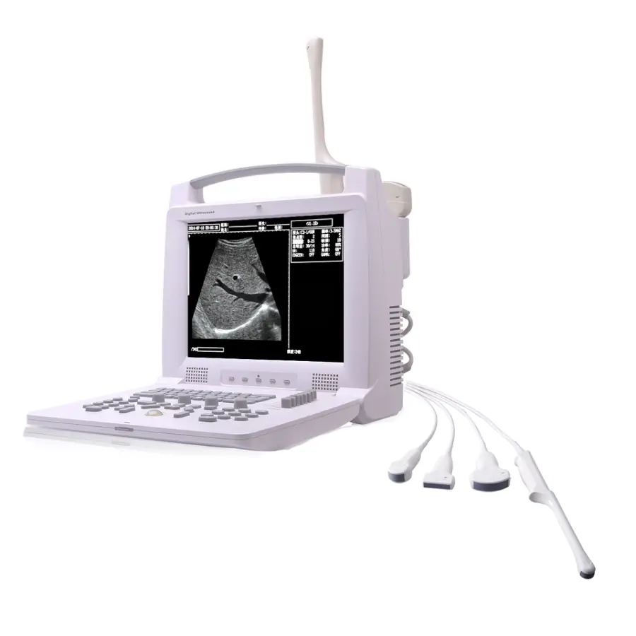 Portable Human B/W Ultrasound Machine Medical B&W Digital Ultrasound Scanner — view 2