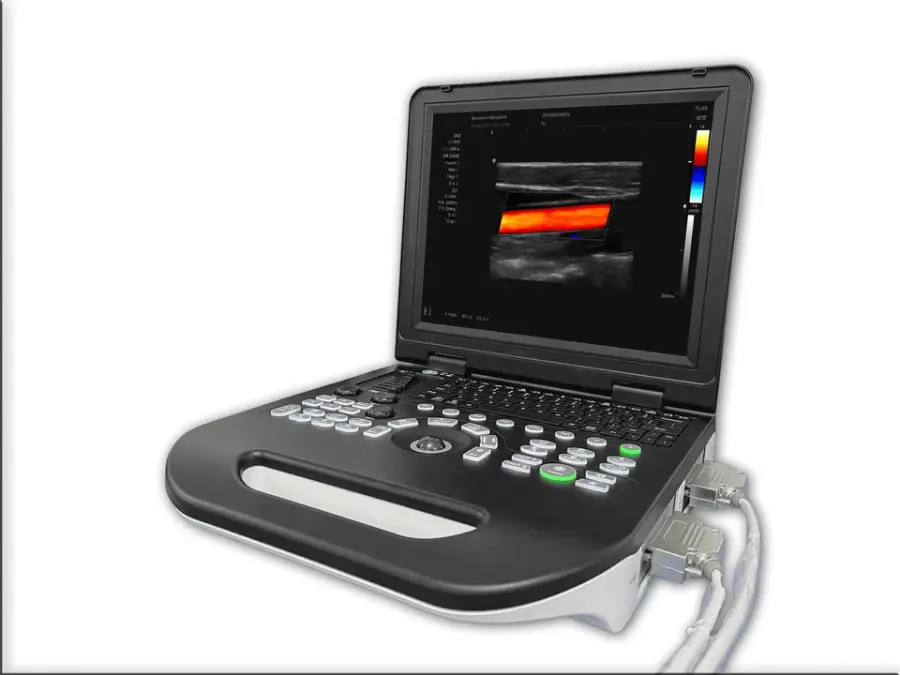 15 Inch Portable Color Doppler Ultrasound All-Digital Color Ultrasound for Hospital — image 3