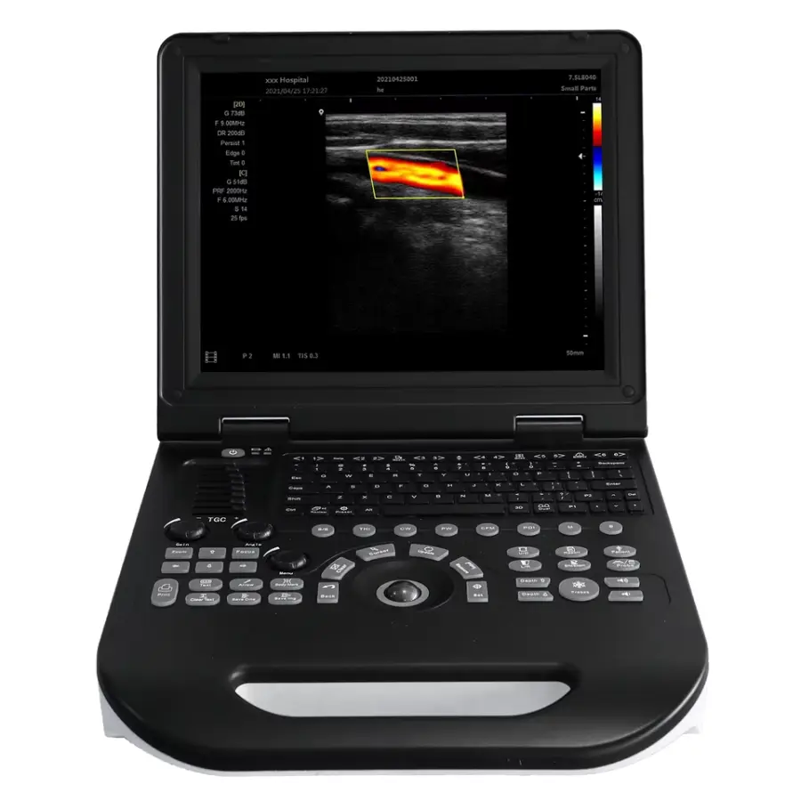 Portable All-Digital Color Ultrasound Ultrasound Scanner with 15 Inch Screen Factory Price — view 1