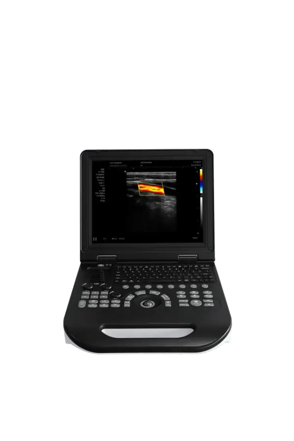 15 Inch Portable Color Doppler Ultrasound All-Digital Color Ultrasound for Hospital — image 6