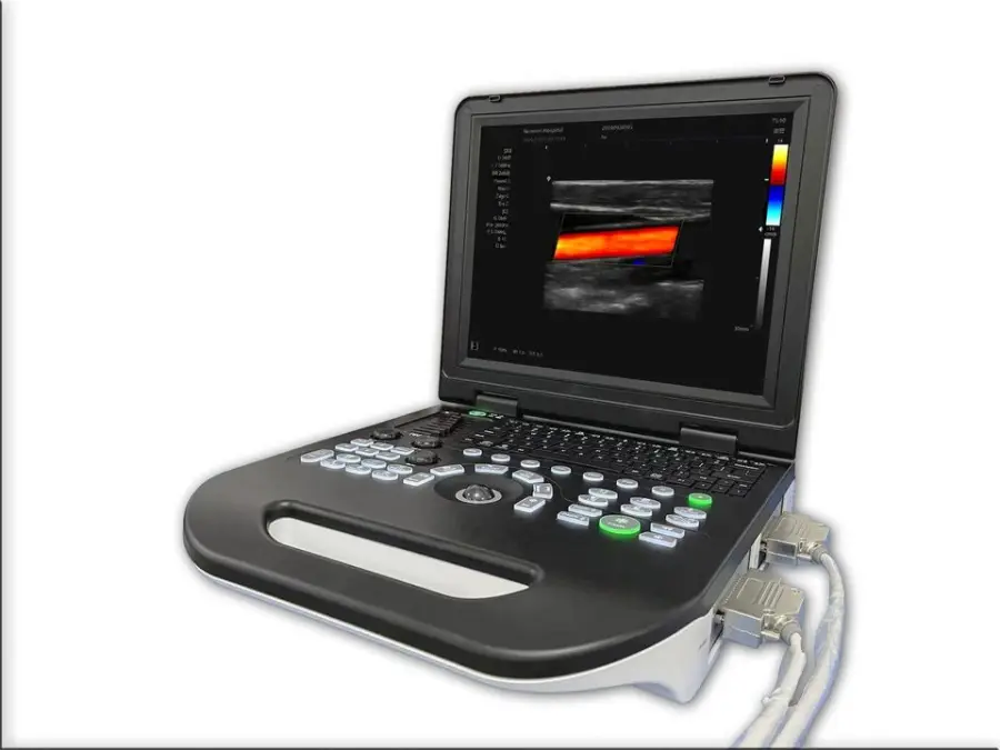 Portable All-Digital Color Ultrasound Ultrasound Scanner with 15 Inch Screen Factory Price — image 5