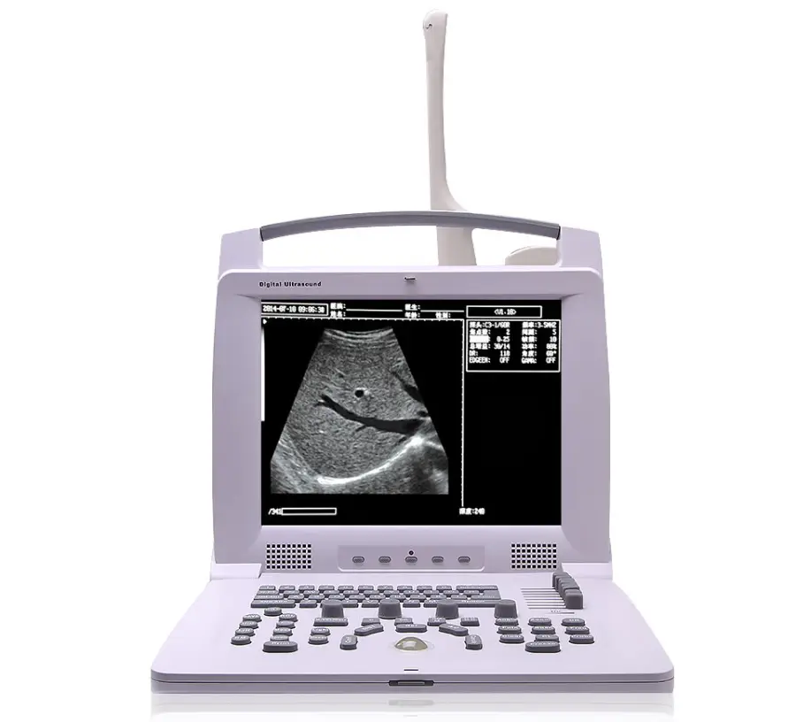 Full Digital Portable Ultrasound Diagnostic System Multi-Probe Compatible for Medical Institutions — view 1