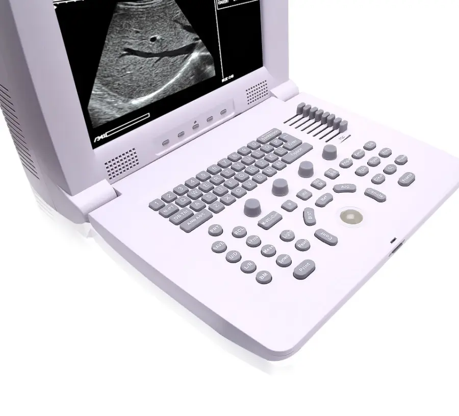 Full Digital Portable Ultrasound Diagnostic System Multi-Probe Compatible for Medical Institutions — view 3