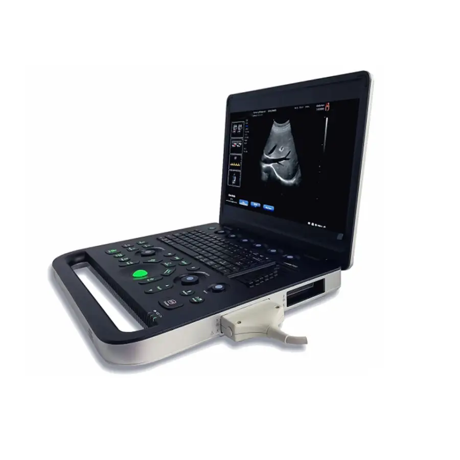 Portable 4D Color Ultrasound Machine 15.6-inch High-resolution Ultrasound Equipment for Human&animal — image 3
