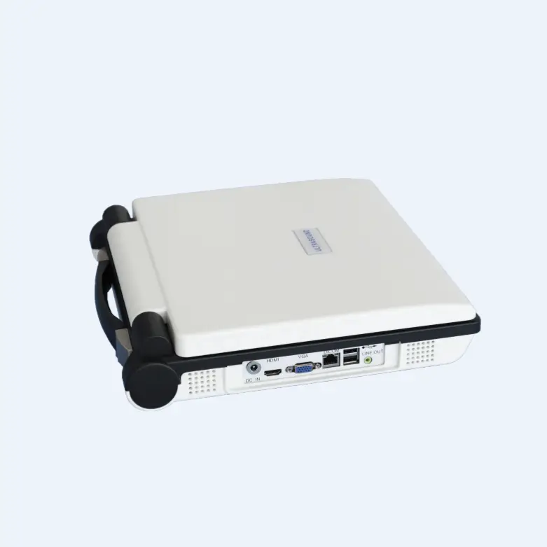 Medical Equipment Portable Laptop Color Hospitals and Clinics Use 3D Ultrasound Machine Ultrasound Scanner — image 7