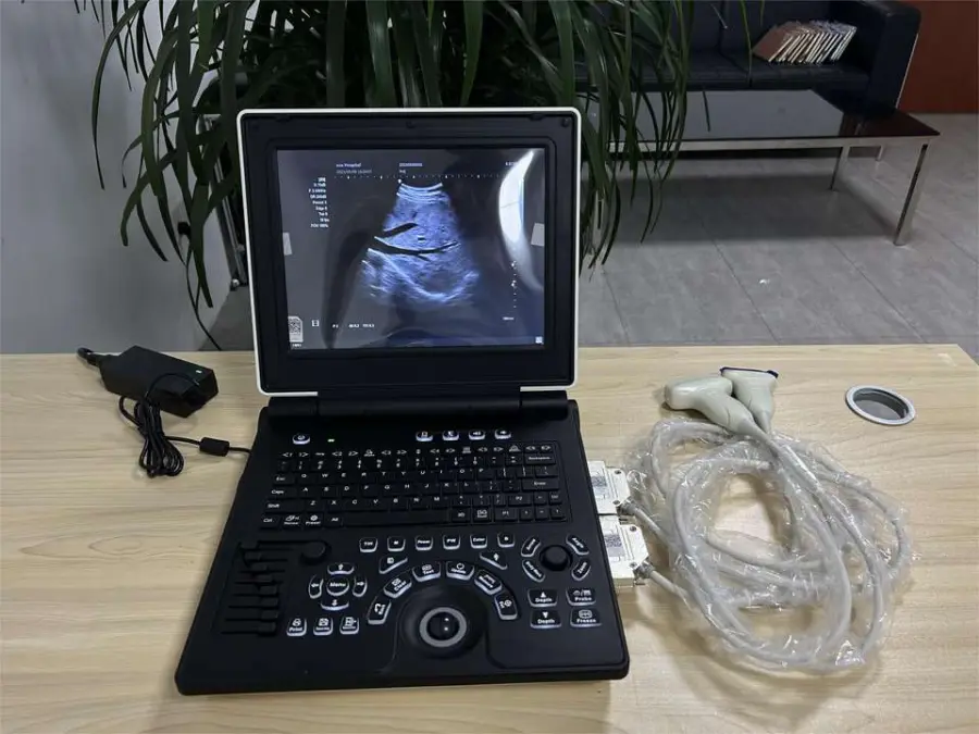 Umy Medical Color Doppler Ultrasound Machine Portable Ultrasound Equipment for Human and Vet Hospital Use — image 2