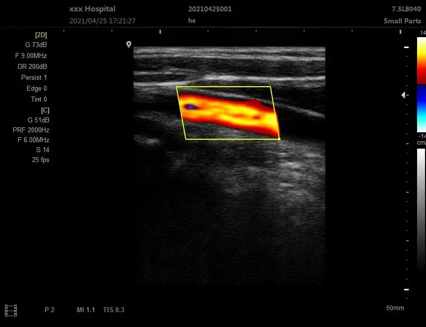 Umy Medical Color Doppler Ultrasound Machine Portable Ultrasound Equipment for Human and Vet Hospital Use — image 4
