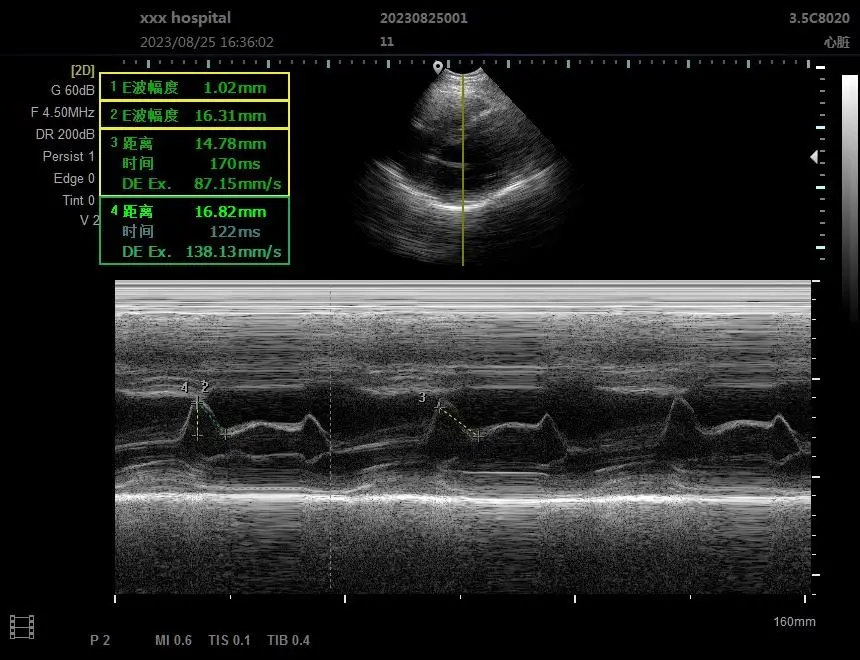 Umy Medical Color Doppler Ultrasound Machine Portable Ultrasound Equipment for Human and Vet Hospital Use — image 5
