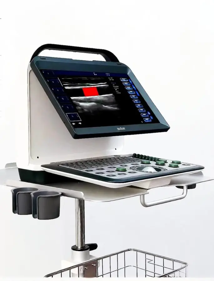 Portable Electric Color Doppler Ultrasound Machine Convex Probe 14" High-Resolution LCD Monitor Imaging Scanner — view 1
