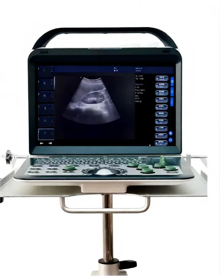 Portable Electric Color Doppler Ultrasound Machine Convex Probe 14" High-Resolution LCD Monitor Imaging Scanner — image 3