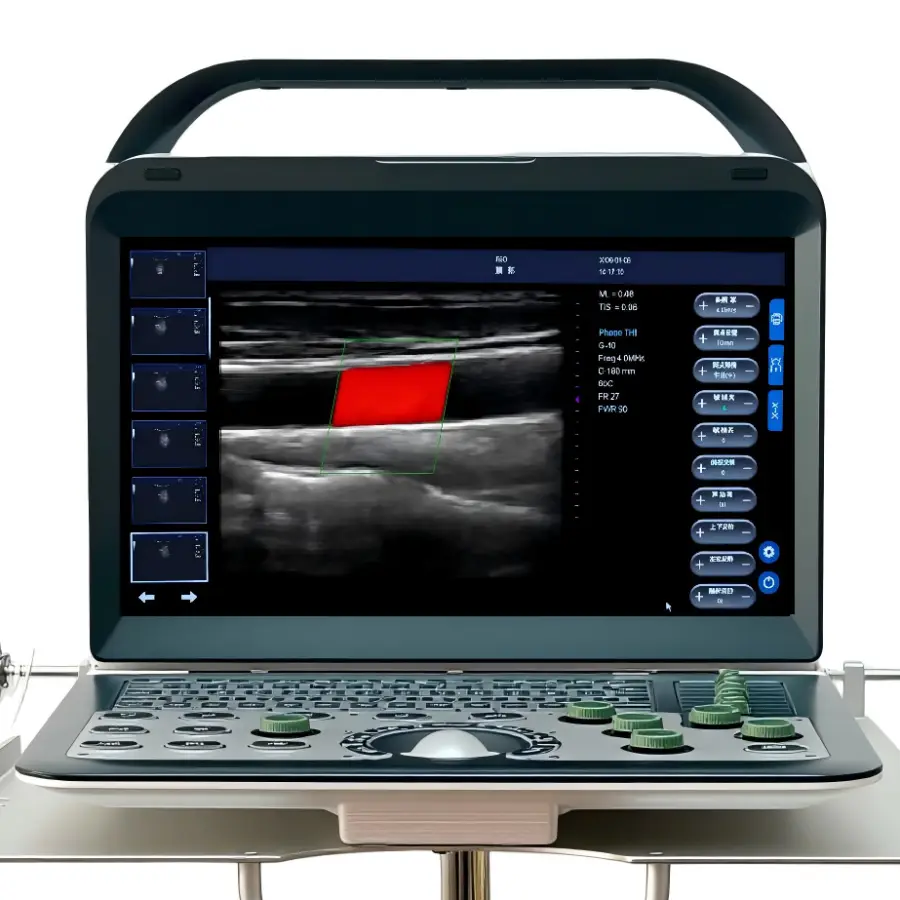 Portable Electric Color Doppler Ultrasound Machine Convex Probe 14" High-Resolution LCD Monitor Imaging Scanner — view 1