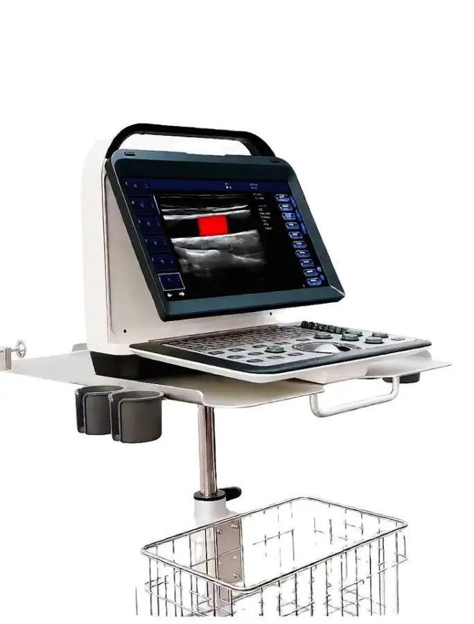 Portable Electric Color Doppler Ultrasound Machine Convex Probe 14" High-Resolution LCD Monitor Imaging Scanner — image 6