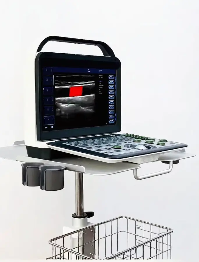 Portable Electric Color Doppler Ultrasound Machine Convex Probe 14" High-Resolution LCD Monitor Imaging Scanner — image 3