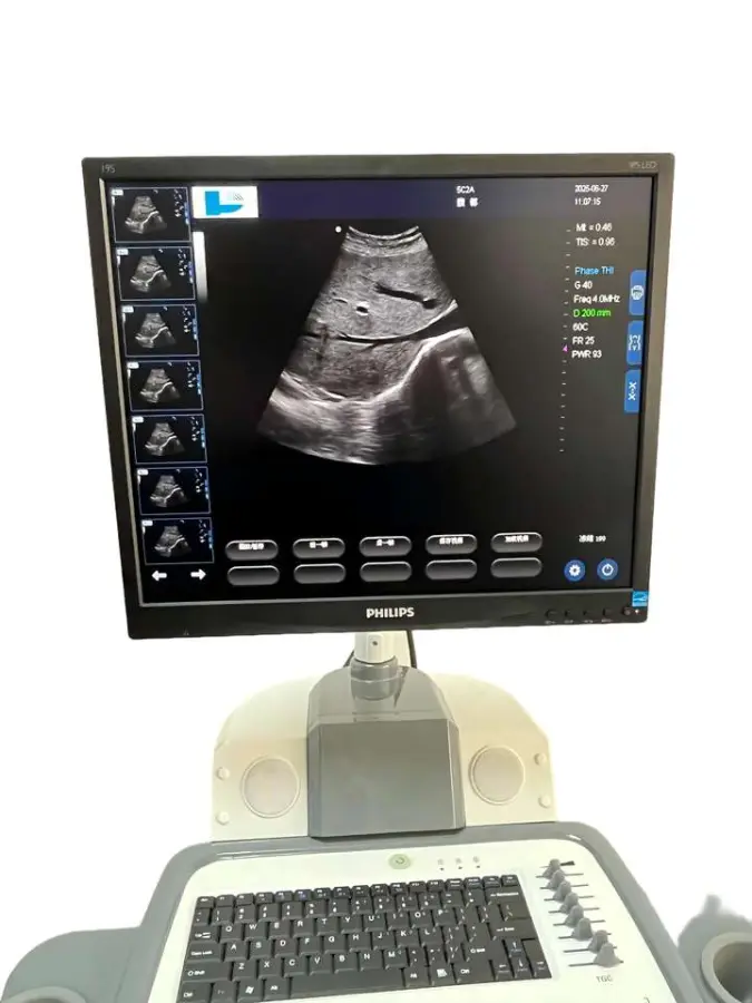 UMY Brand CE Certified 1 Year Warranty Ultrasound Machine Color Doppler 3D/4D Ultrasound 12 Inch Touch Screen — image 4