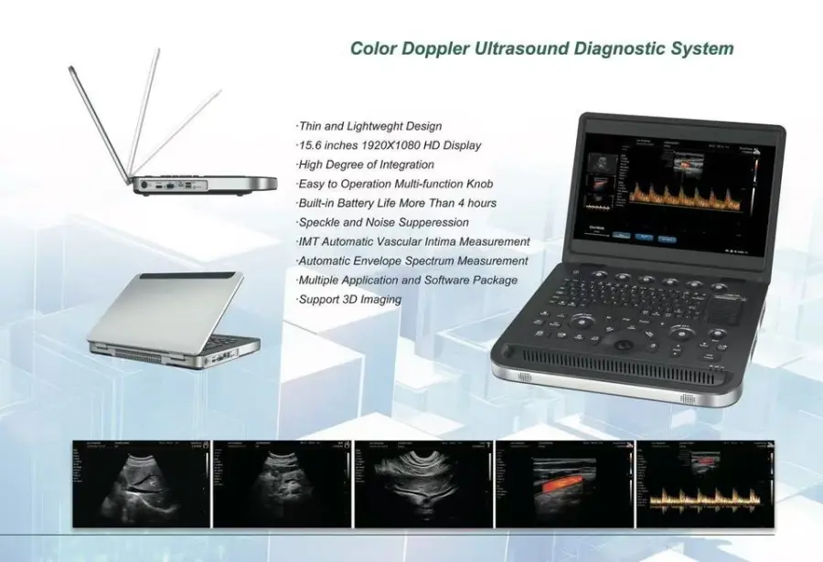 New Year Hot Selling Model Triple Color Doppler Ultrasound Machine Portable Ultrasound Machine — image 4