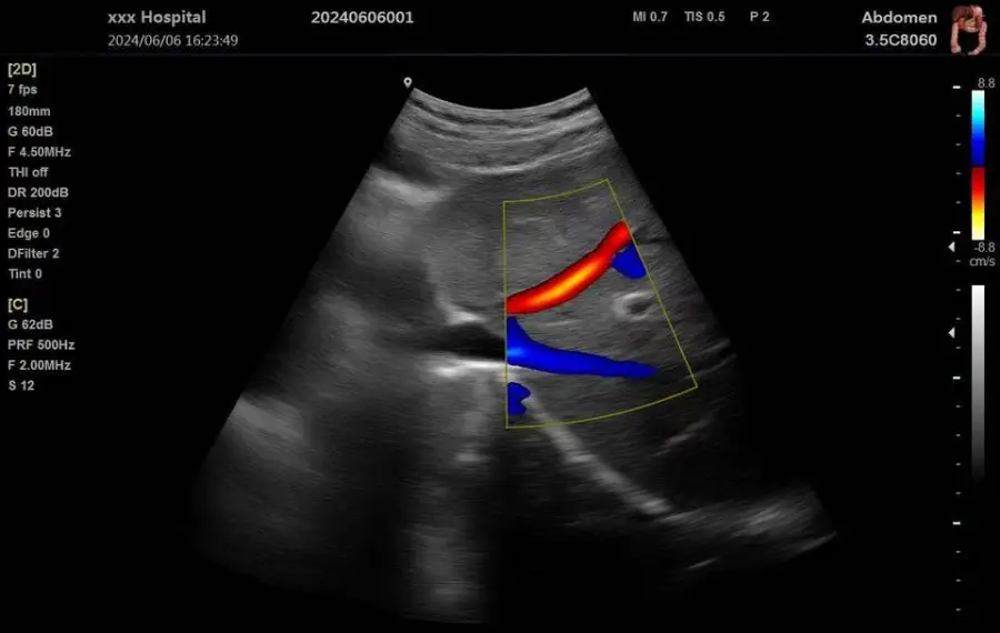 New Year Hot Selling Model Triple Color Doppler Ultrasound Machine Portable Ultrasound Machine — image 5