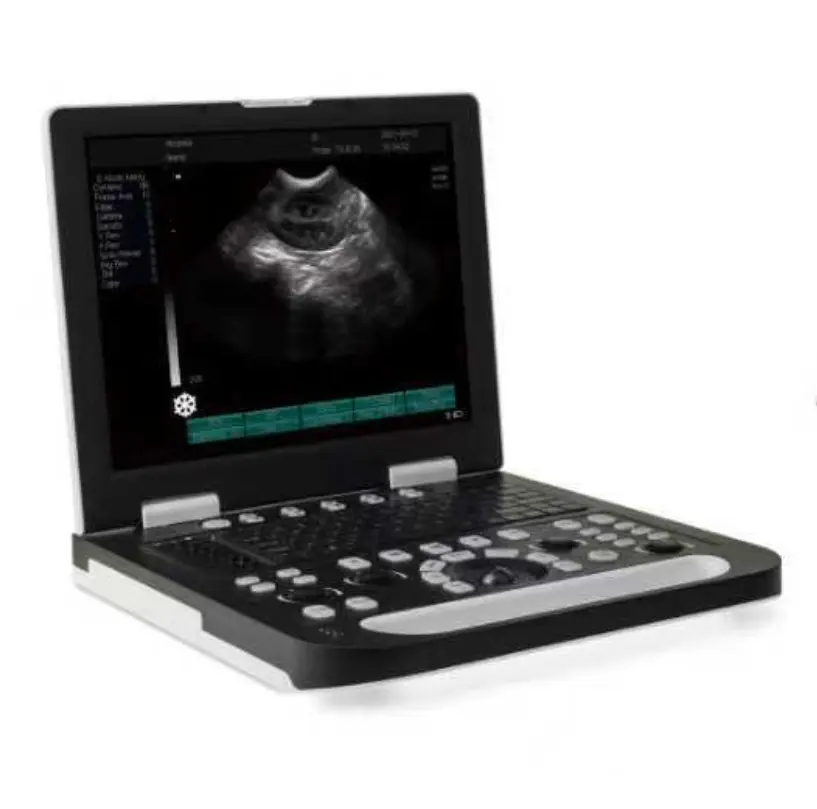 Veterinary Use 15'' Full Medical LCD Screen Ultrasound Machine Black and White Ultrasound Machine for Animal Use — view 1