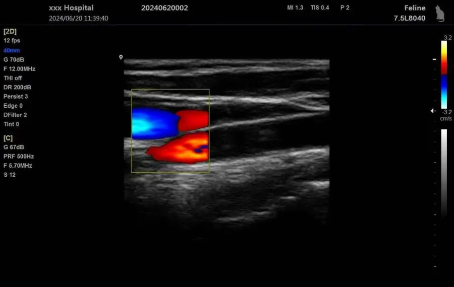 New Year Hot Selling Model Triple Color Doppler Ultrasound Machine Portable Ultrasound Machine — image 6