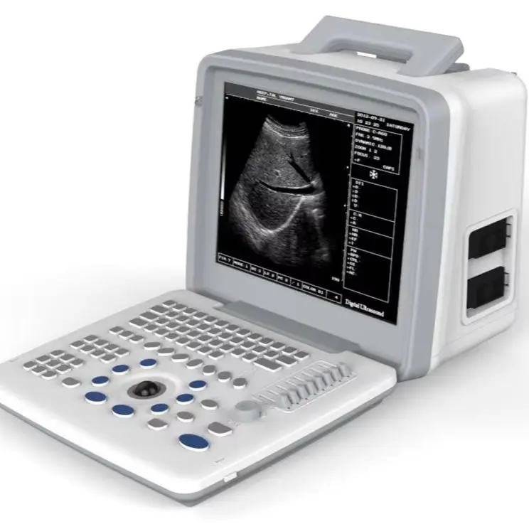 UMUS026 Portable Black and White Ultrasound Machine BW Ultarsound Equipment with Convex Probe — view 1