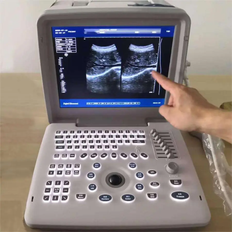 UMUS026 Portable Black and White Ultrasound Machine BW Ultarsound Equipment with Convex Probe — image 4