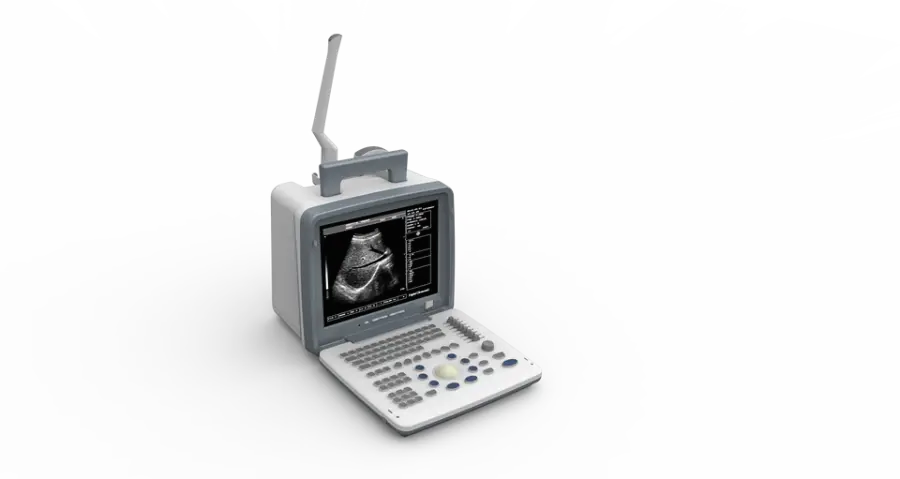 UMUS026 Portable Black and White Ultrasound Machine BW Ultarsound Equipment with Convex Probe — image 5