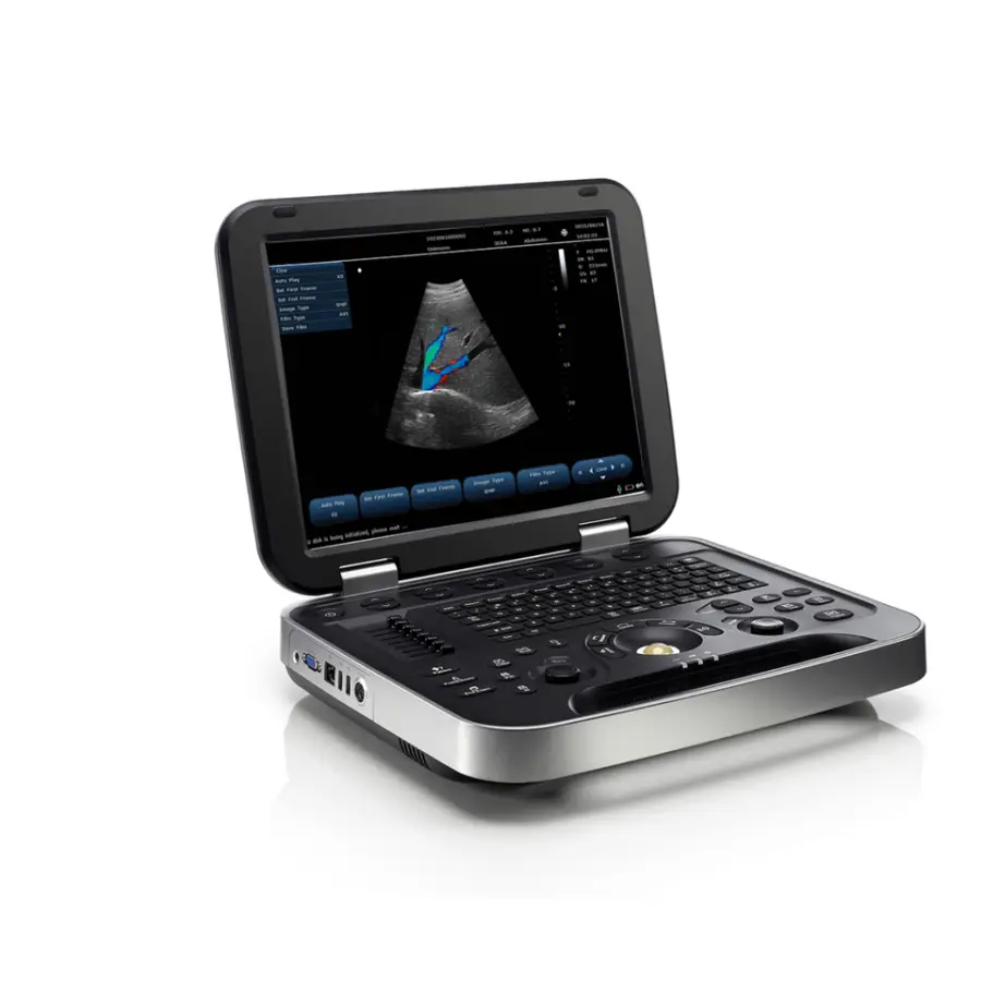 15 Inch HD LED Display Portable Ultrasound Machine Sen Factory Direct Sale Reasonable Price — view 1