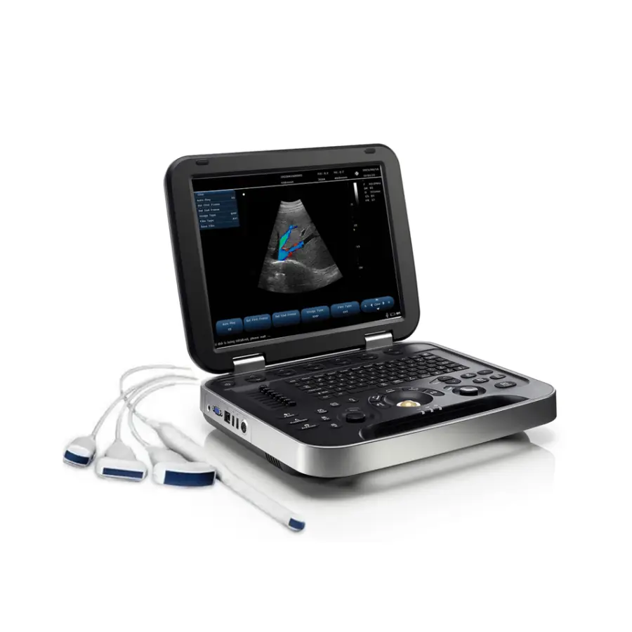 15 Inch HD LED Display Portable Ultrasound Machine Sen Factory Direct Sale Reasonable Price — image 4