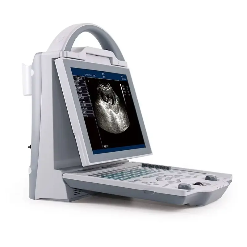 New Portable LED Model Portable Ultrasound Machine Black and White Ultrasound Machine Equipment for Clinic Use — view 1