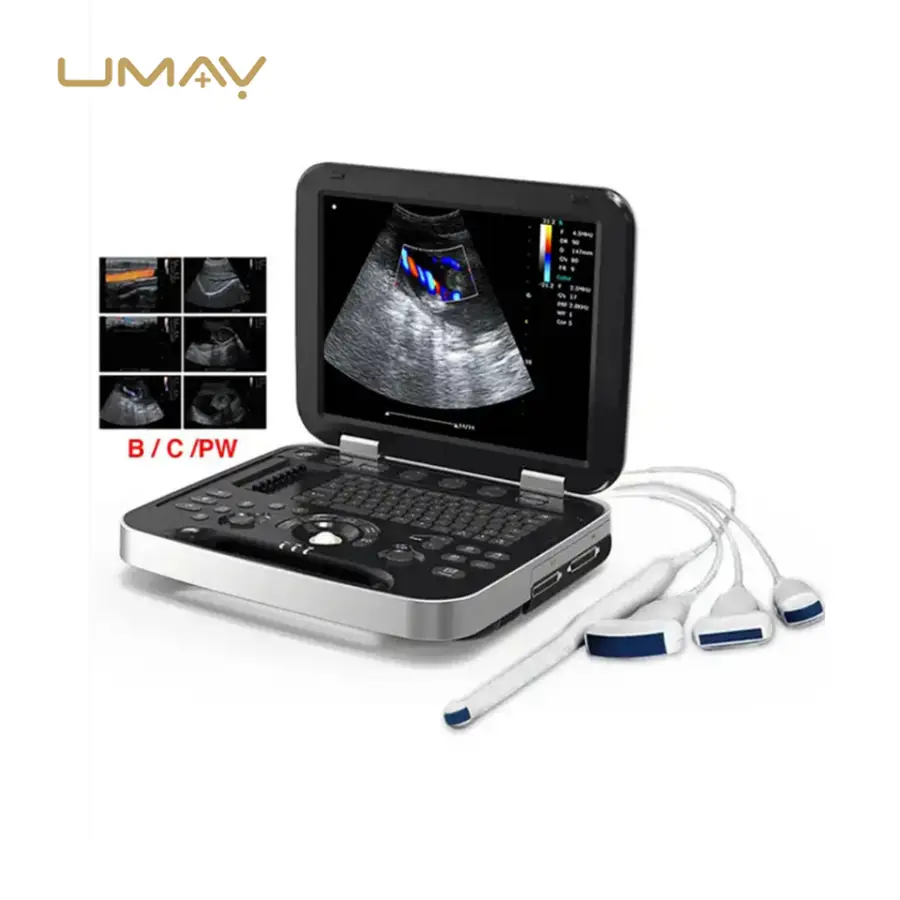 15 Inch HD LED Display Portable Ultrasound Machine Sen Factory Direct Sale Reasonable Price — image 6