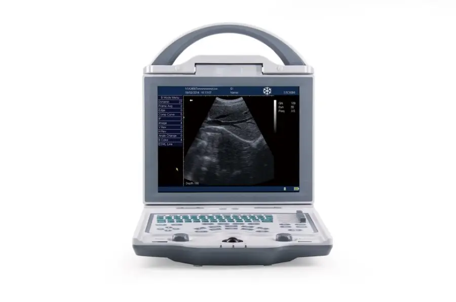 New Portable LED Model Portable Ultrasound Machine Black and White Ultrasound Machine Equipment for Clinic Use — image 2