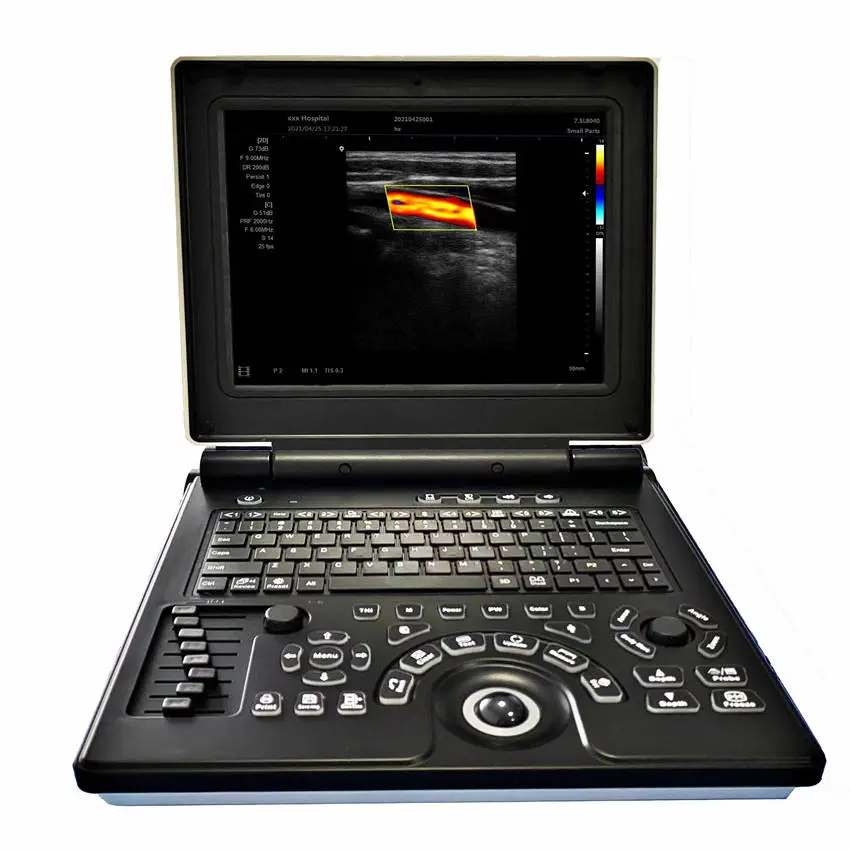 SONOSCOPE UM-SN-X3 E20 Electric Medical Ultrasound Machine Color Doppler Echocardiography Convex Probe High Resolution 1 — view 1