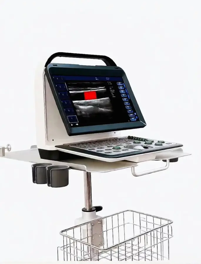 Reliable Portable Color Doppler Clear Imaging with Easy Operation for Mobile Healthcare — view 1