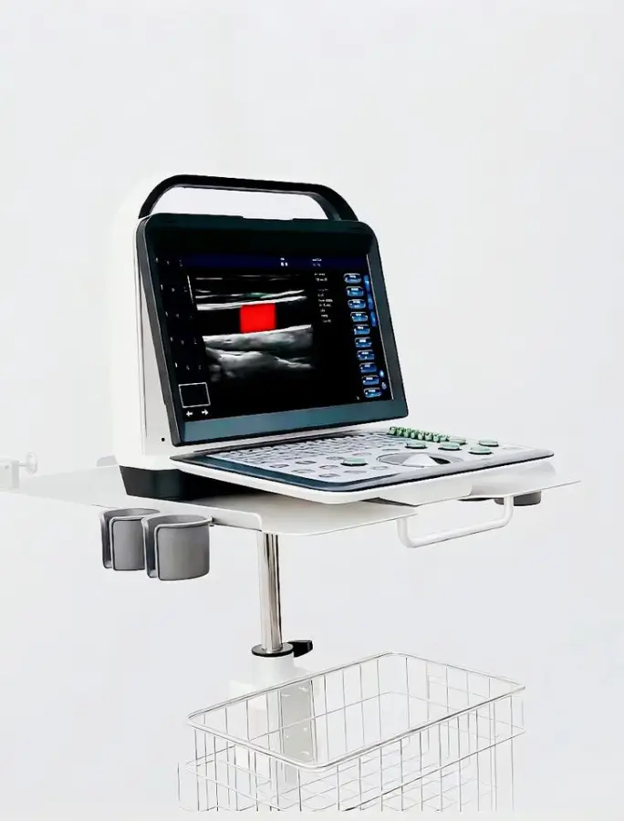 Reliable Portable Color Doppler Clear Imaging with Easy Operation for Mobile Healthcare — image 2