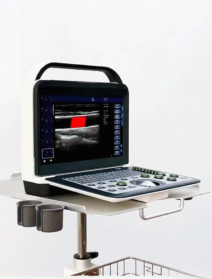 Reliable Portable Color Doppler Clear Imaging with Easy Operation for Mobile Healthcare — image 3