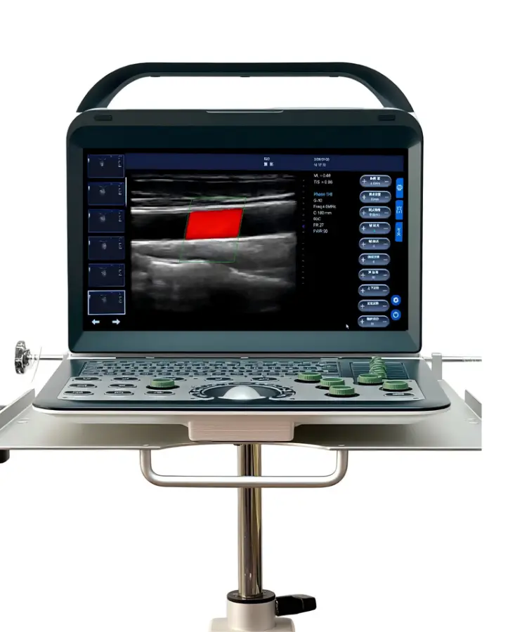 Reliable Portable Color Doppler Clear Imaging with Easy Operation for Mobile Healthcare — image 4