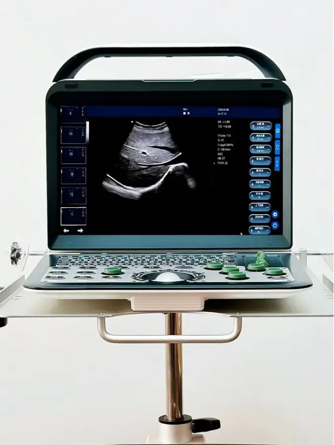 Reliable Portable Color Doppler Clear Imaging with Easy Operation for Mobile Healthcare — image 5