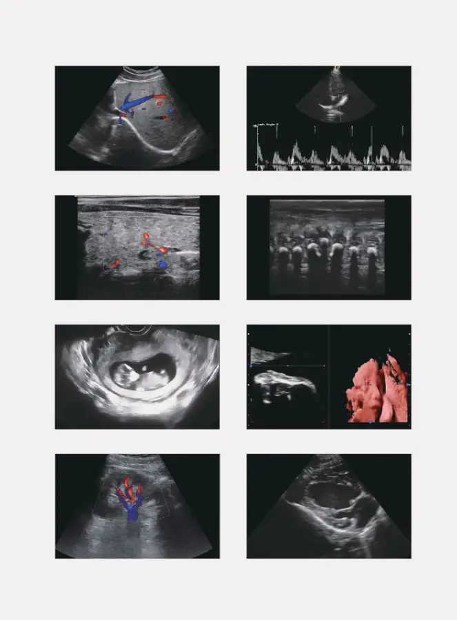 High Quality 3D/4D Trolley Ultrasound Color Doppler Ultrasound Machine with Certification for Hospital Use — image 5