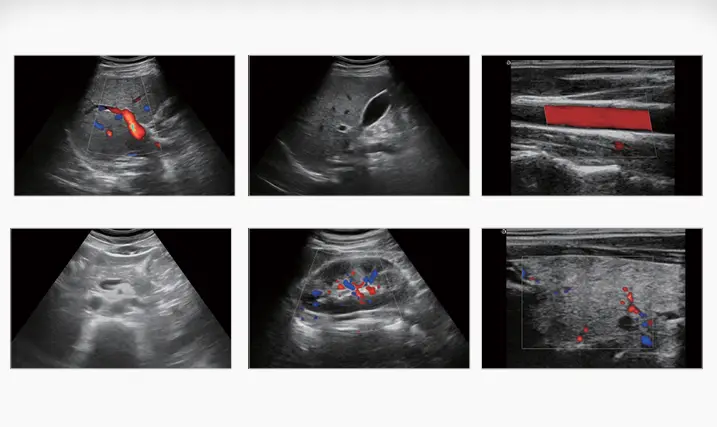 Trolley 21.5 Inch LED Color Doppler Ultrasound Machine 2D Function Ultrasound Machine Easy to Use — view 6